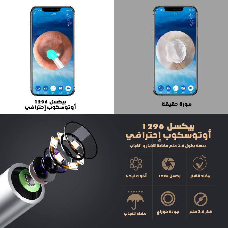 جهاز تنظيف الأذن الذكي من  NE3 - 1SATOR.SHOP